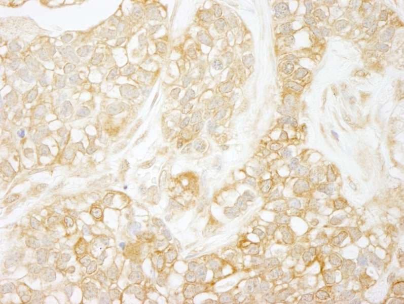 RELA / NFKB p65 Antibody (aa501-551)