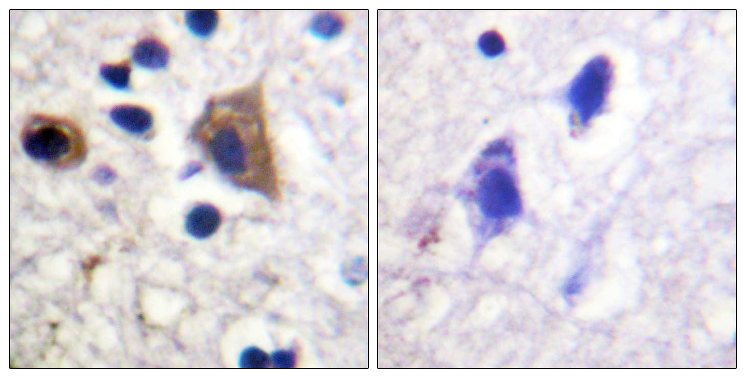 Polyclonal Rabbit anti-Human PIKFYVE / PIP5K Antibody (aa273-322, IHC)