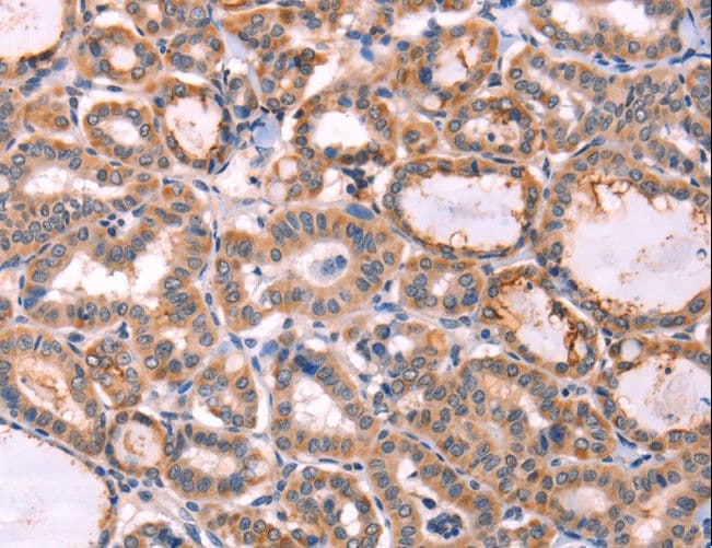Polyclonal Rabbit anti-Human PROS1 / Protein S Antibody (IHC)
