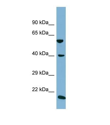SLC2A10 / GLUT10 Antibody (aa343-392)