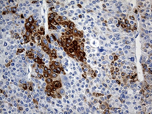 TFF1 / pS2 Antibody (aa25-84, clone OTI5H5)
