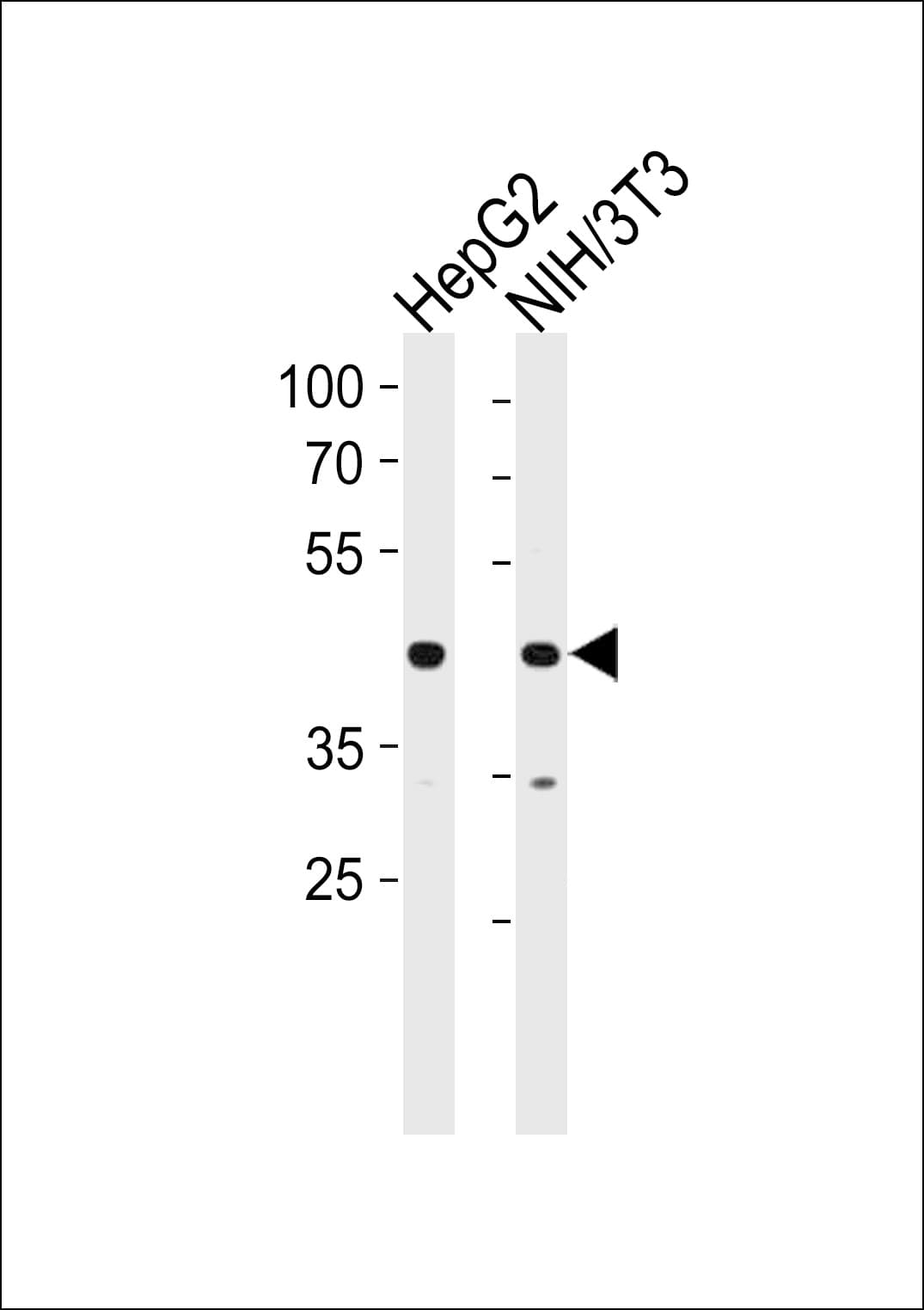 IHC-plus™ COUP-TFII / NR2F2 Antibody (aa1-30)