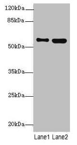 Polyclonal Rabbit anti-Human STAM2 Antibody (IHC, WB)
