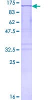 Human MARS Protein (Recombinant GST)