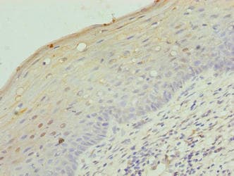 LRRC18 Antibody