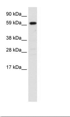 HNF4A / HNF4 Antibody (N-Terminus)