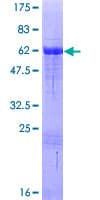 Human VGLL2 Protein (Recombinant GST)