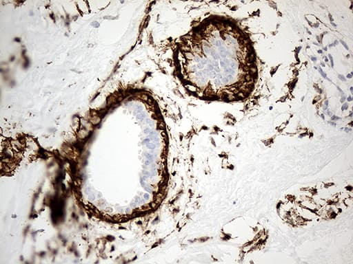 Monoclonal Mouse anti-Human MRC2 / Endo180 Antibody (clone OTI9G4, IHC, WB)