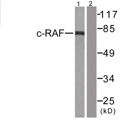 Polyclonal Rabbit anti-Human RAF1 / RAF Antibody (aa11-60, IHC, WB)