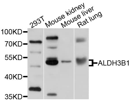 ALDH3B1 Antibody