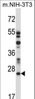 LAPTM4A Antibody (aa1-30)