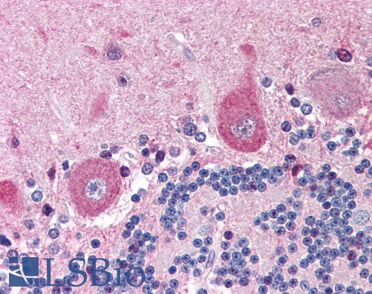 IHC-plus™ NGFR / CD271 / TNR16 Antibody