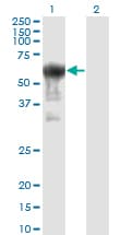 IHC-plus™ Monoclonal Mouse anti-Human PRUNE Antibody (clone 1C11, IHC, WB)
