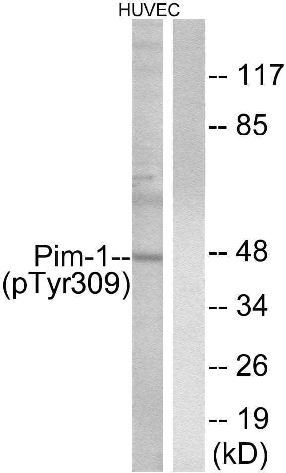 PIM1 / Pim-1 Antibody (phospho-Tyr309)