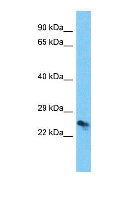 TMED6 Antibody (aa136-185)