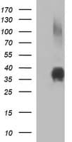 EPCAM Antibody (clone OTI2D7, Carrier-free)