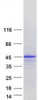 Human MTFR1 Protein (Recombinant Myc-DDK (Flag))