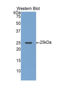 IGFBP6 Antibody (aa46-238)