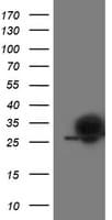 IHC-plus™ PGAM2 Antibody (clone 4E9)