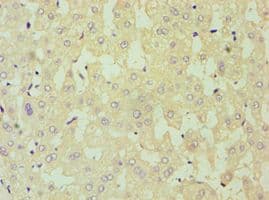 DKK4 Antibody (aa19-224)