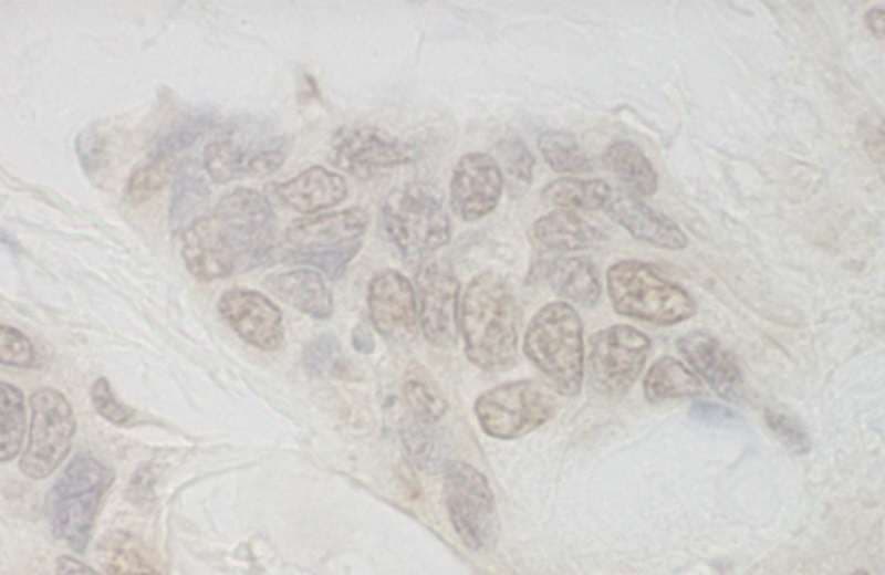 Polyclonal Rabbit anti-Human AQR Antibody (aa1435-1485, IHC)