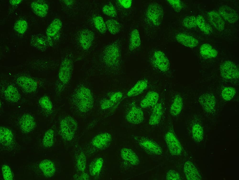 Polyclonal Rabbit anti-Human CTBP1 / CTBP Antibody (aa409-440, IHC, WB)