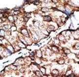 DKKL1 / Soggy-1 Antibody (aa213-242)