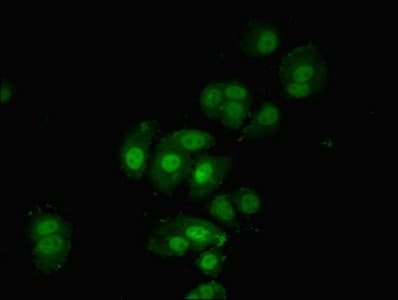 Polyclonal Rabbit anti-Human PDPK1 / PDK1 Antibody (aa277-556, IHC)