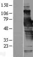 SCHIP1 Protein (Over-Expression Lysate Myc-DDK (Flag))