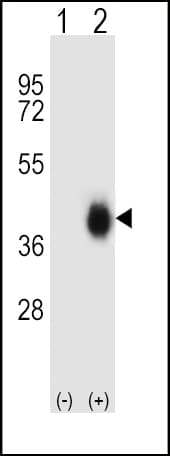 IHC-plus™ FCAR / CD89 Antibody (aa58-84)