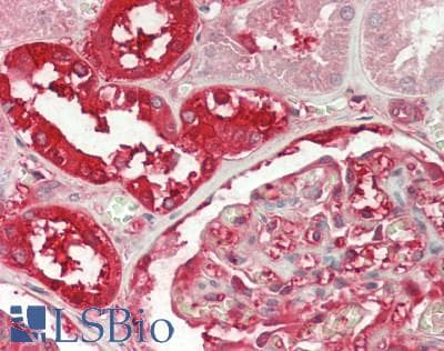 Polyclonal Rabbit anti-Human GSTP1 / GST Pi Antibody (aa1-210, IHC, WB)