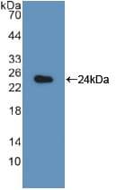PSMB8 / LMP7 Antibody (aa80-261)