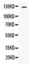 ACLY / ATP Citrate Lyase Antibody