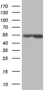 MSLN / Mesothelin Antibody (aa270-493, clone OTI8H7)