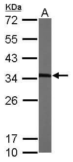 MMACHC Antibody (aa1-218)