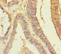 RBPMS / Hermes Antibody
