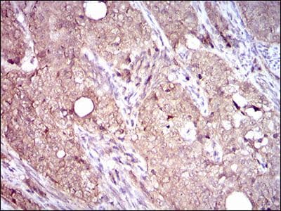ITGB4 / Integrin Beta 4 Antibody (Amino Acid: 1619-1822, clone 10B10D5)