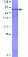 Human DHCR7 Protein (Recombinant GST)