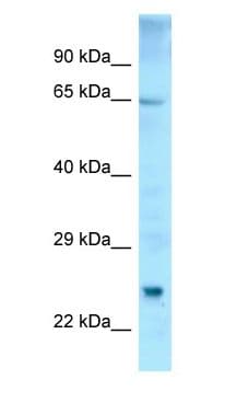 ETFDH Antibody (aa426-475)