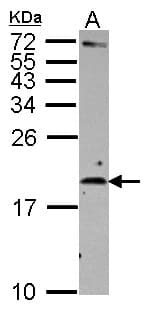 IL2 Antibody