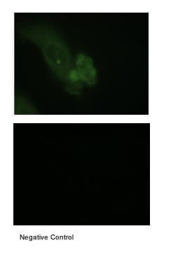EMA / MUC1 Antibody (aa1192-1241)