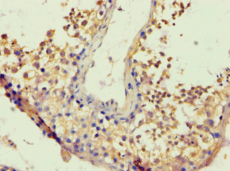 BACH1 Antibody (aa1-320)