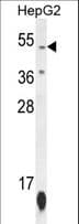ZNF566 Antibody (aa110-138)