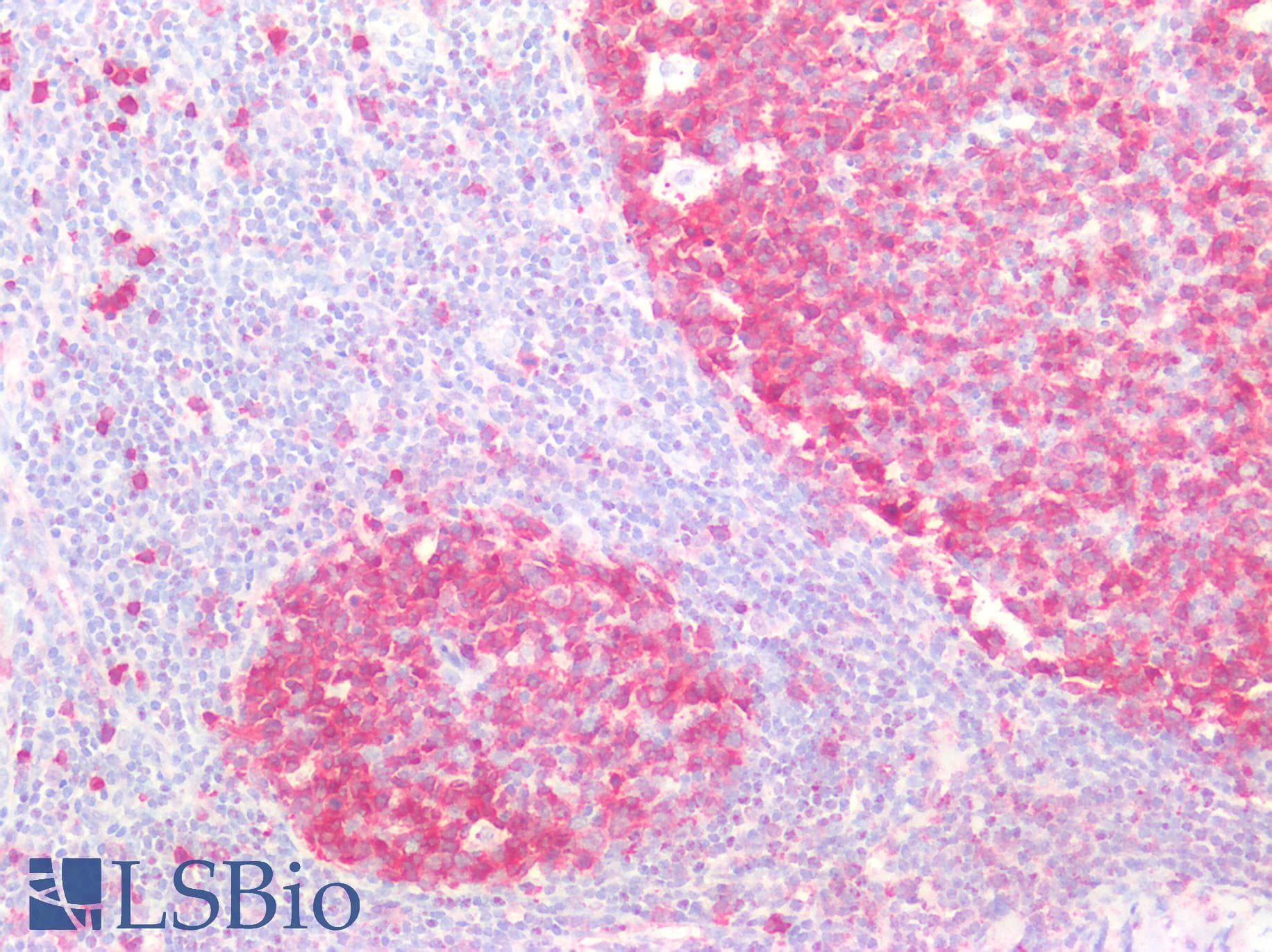 IHC-plus™ Polyclonal Rabbit anti-Human STMN1 / Stathmin / LAG Antibody (IHC, IF, WB)