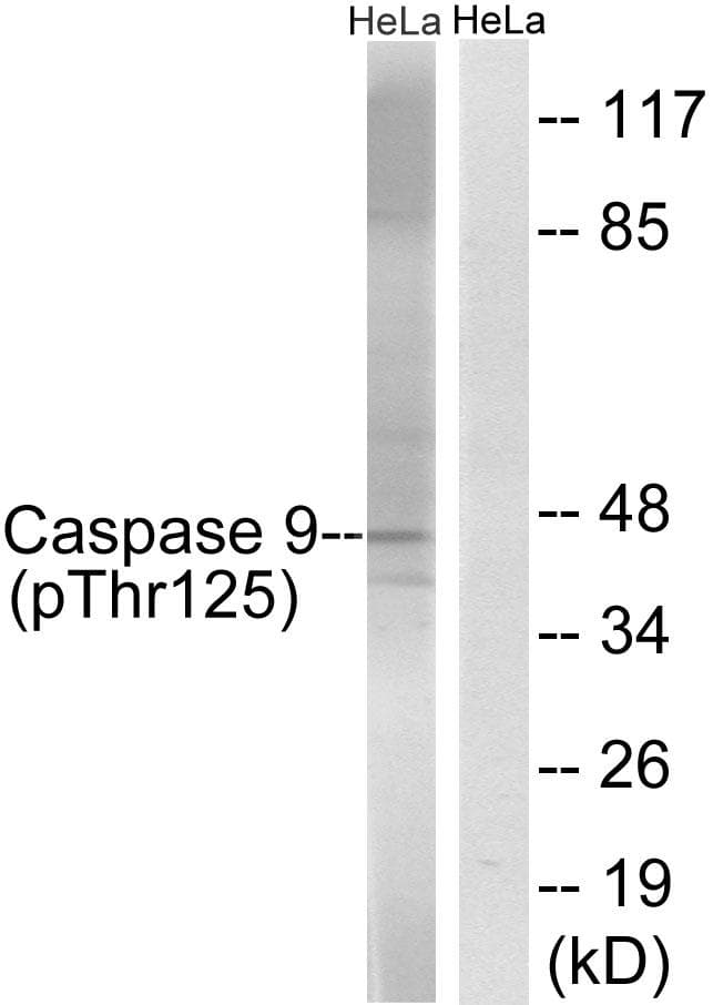 CASP9 / Caspase 9 Antibody (phospho-Thr125)