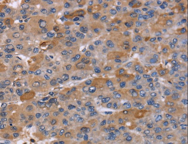 NCF2 / NOXA2 / p67phox Antibody