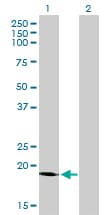 SSR4 Antibody (clone 2D3)