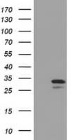 Monoclonal Mouse anti-Human UCK1 Antibody (clone OTI4C2, IF, WB)