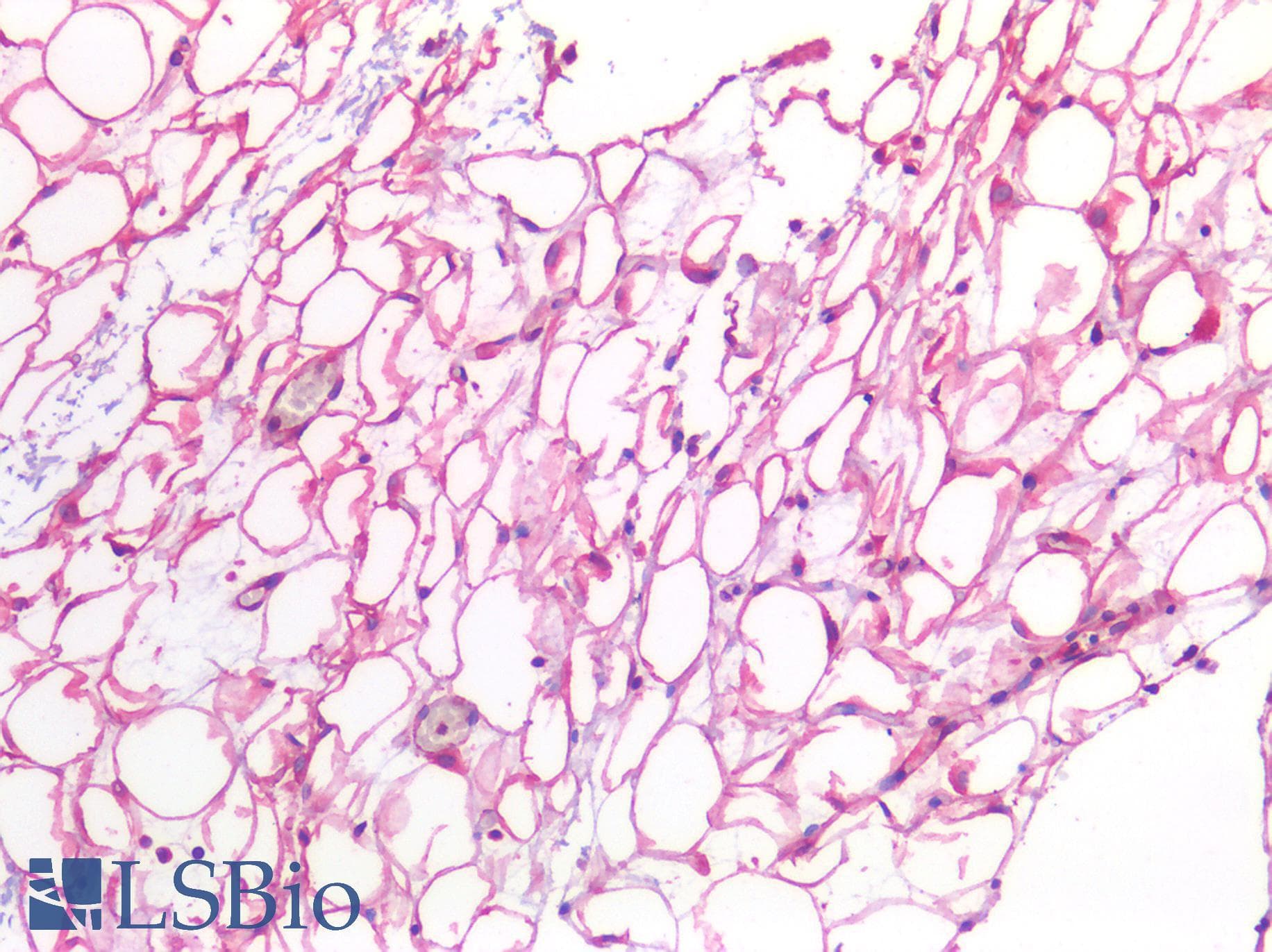 IHC-plus™ IL6 / Interleukin 6 Antibody
