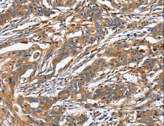 Polyclonal Rabbit anti-Human GNA13 Antibody (IHC, WB)